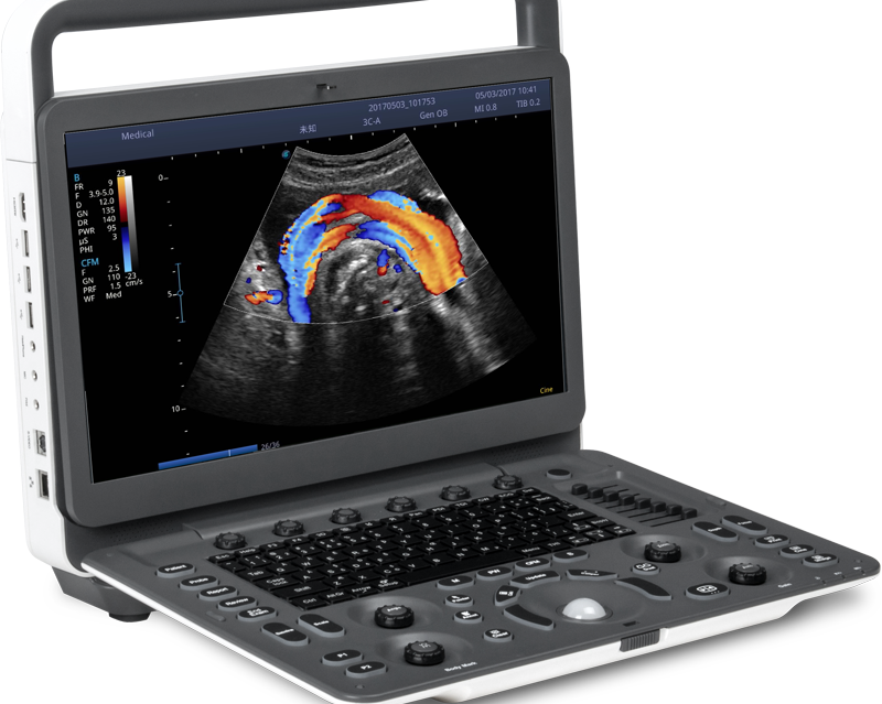 E2 V With Wifi Module and ECG, CW, Prospective Saving 