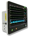Veterinary Monitor with Touch screen,  EtCO2(Sidestream), SpO2, ECG, RESP, HR, NIBP and TEMP